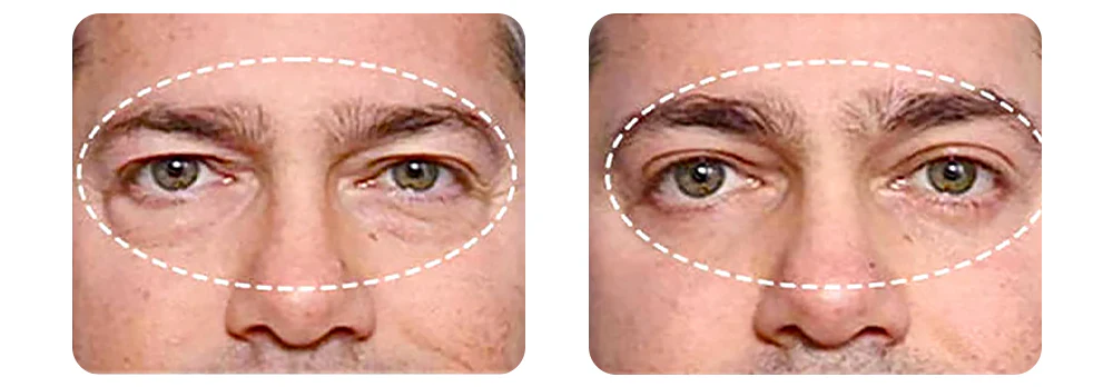 Seurico™ PEPTIDE Depuffing Eye Serum