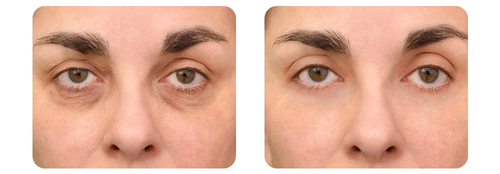 Seurico™ PEPTIDE Depuffing Eye Serum