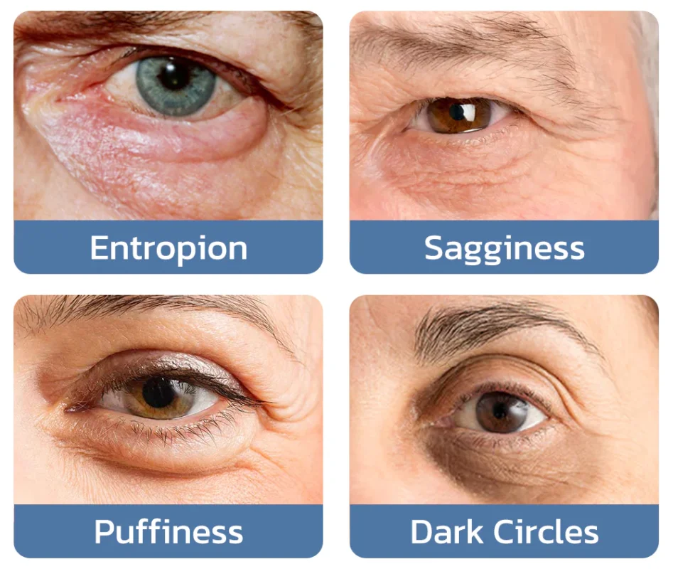 Seurico™ PEPTIDE Depuffing Eye Serum