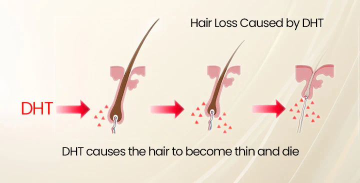 Unpree™ Ginger Hair Regrowth Serum