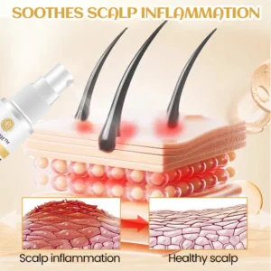 Unpree™ Ginger Hair Regrowth Serum