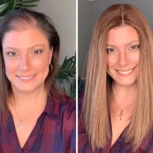 Unpree™ Hair Density Boost Capsules