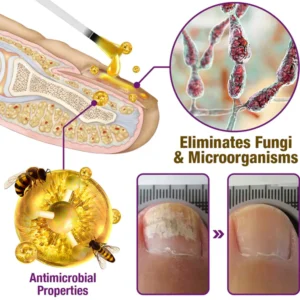 LOVILDS™ FungiFree Bee Venom Nail Treatment Serum