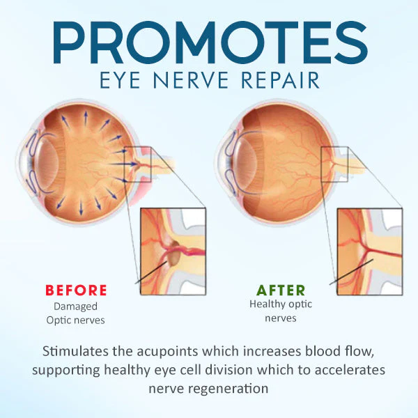 AEXZR™ acu terapijas plāksteris