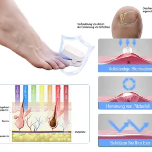 Dispositiu revolucionari de teràpia amb llum d'alta eficiència AEXZR™ per a la malaltia de les ungles dels peus