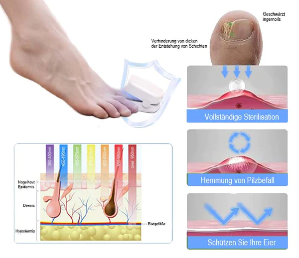 AEXZR™ อุปกรณ์บำบัดด้วยแสงประสิทธิภาพสูงที่ปฏิวัติวงการสำหรับโรคเล็บเท้า