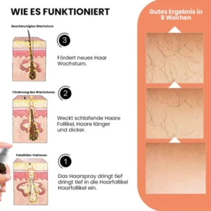 Ashwagandha 4500 Haarwachstumsspray