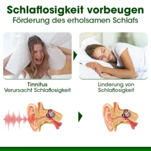 Biancat™ RingAway Olivenblatt Tinnitus-Creme
