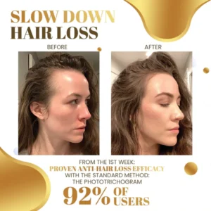 Biotin Haarwuchs Roll-On Massage-Essenz