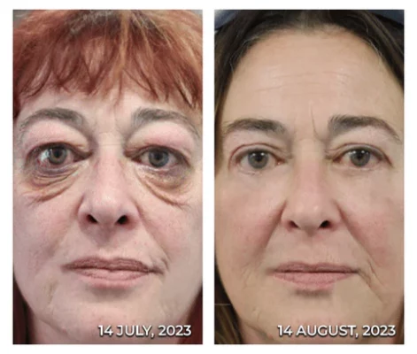 CC™ RadiantEyes Collagen Lifting Eye Balm Stick