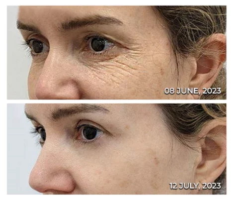 CC™ RadiantEyes Collagen Lifting Eye Balm Stick