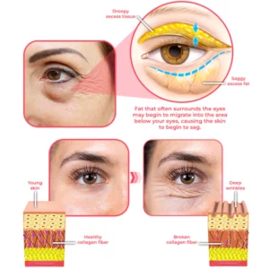 CC™ RadiantEyes Collagen Lifting Eye Balm Stick