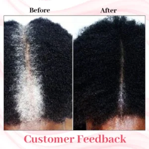 Ceoerty™ BlackSheen Shampoo Bar
