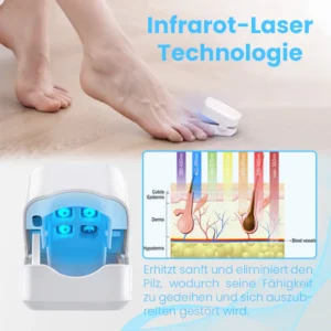 Ceoerty™ FungiGuard Nagellaser-Therapiegerät