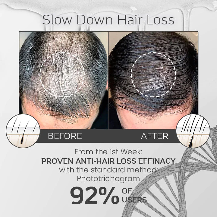 Ceoerty™ LocksGuard Anti-Hairloss Spray