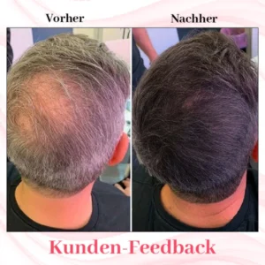Ceoerty™ SchwarzerScheen Shampoo Bar