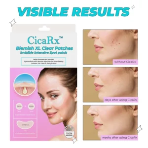 CicaRx™ Blemish XL Clear Patches
