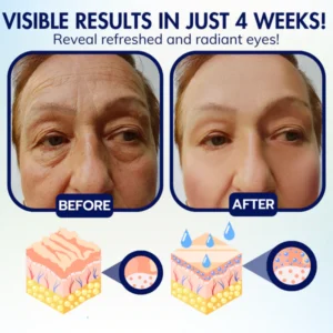 Dobshow™ Advanced Eye Retain Youth Cream