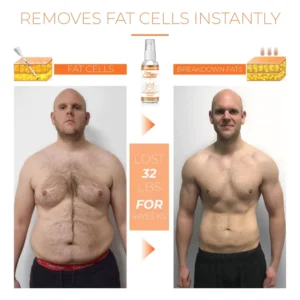 Alternative view of FORMAN Gynecomastia FatBurning Spray