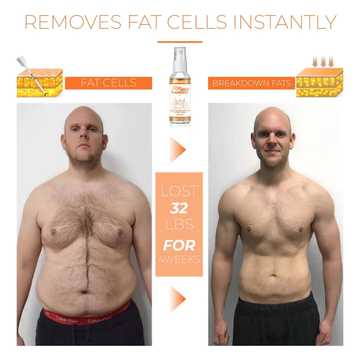 FORMAN Gynecomastia FatBurning Spray - Image 2