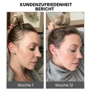 Furzero™ ShougaGRO Japanisches Haarwachstumsspray