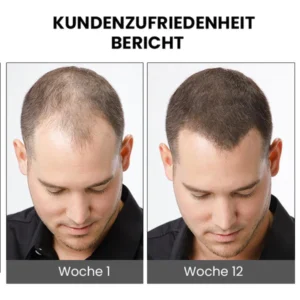 Furzero™ ShougaGRO Japanisches Haarwachstumsspray
