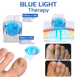 Alternative view of GFOUK™ FungusOFF Nail Laser Treatment Device