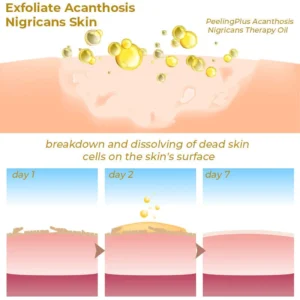 GFOUK™ PeelingPlus Acanthosis Nigricans Therapy Oil