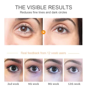 Glitzon™ Lutein Rollerball Essence for Digital Eye Strain Defense