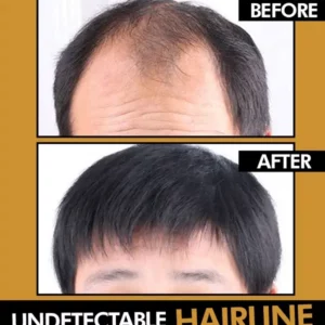 Men's Hair Topper
