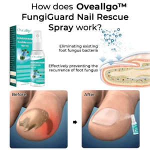 Oveallgo™ FungiGuard Nail Rescue Spray