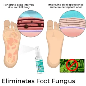 Oveallgo™ FungiGuard Nail Rescue Spray