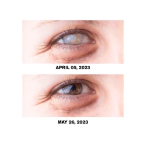 Alternative view of Oveallgo™ OptiClear Eye Problems Solution Drops