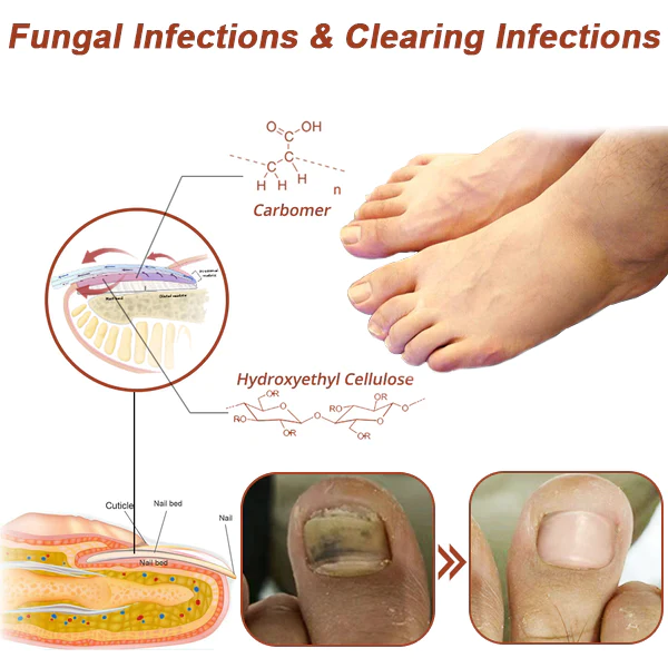 Oveallgo™ ProX Revolutionary High-Efficiency Light Therapy Device For Toenail Diseases