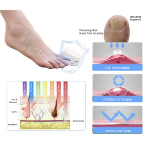 Oveallgo™ ProX Revolutionary High-Efficiency Light Therapy Device For Toenail Diseases