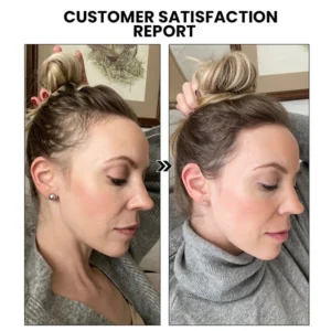 Oveallgo™ ShougaGRO Advanced Japanese Hair Growth Spray