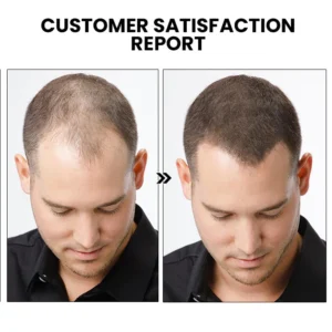 Oveallgo™ ShougaGRO Advanced Japanese Hair Growth Spray