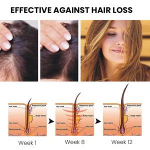 Oveallgo™ ShougaGRO Advanced Japanese Hair Growth Spray