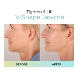 Plumping Anti-Wrinkle Patches