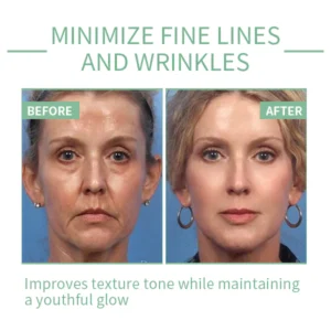 ROZINO™ 30 Days Advanced Collagen Boost Anti-Aging Botox Face Serum