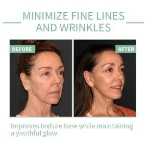 ROZINO™ 30 Days Advanced Collagen Boost Anti-Aging Botox Face Serum