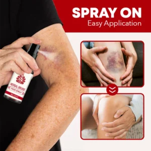 SOUTH MOON™ Herbal Bruise Fixer Spray