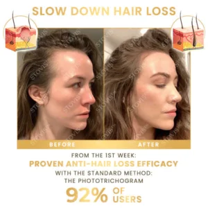 Sekkain™ Biotin-Haarverstärker