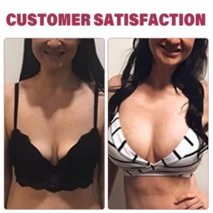 TLOPA™ Breast Enhancement Patch