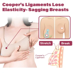 TLOPA™ Breast Enhancement Patch