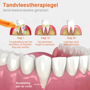 Unpree™ Tandvleesherstelbehandeling Ampullen