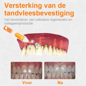 Unpree™ Tandvleesherstelbehandeling Ampullen