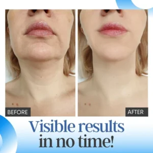 V-Face™ EMS Sleeping Beauty Device
