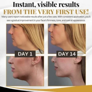 V-Shape™ Slimming MaskV-Shape™ Slimming Mask