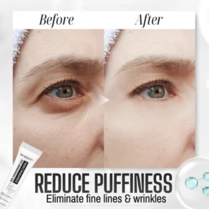 WE.Beauti™ Niacinamide Eye Awakening Gel